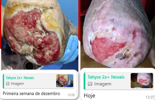 Imagens compartilhadas na comunidade mostrando a evolução de uma ferida